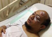 Diduga Efek Bongkar Kasus e-KTP, Novel Baswedan Disiram Air Keras